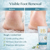 Health & Beauty Dead Sea Minerals Foot Peeling Cream 200ml – Exfoliating Foot Care for Dry Skin, Rough Heels, Smooth Feet & Deep Cleansing Treatment